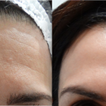 pre-post